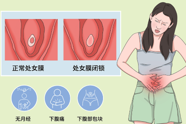 处女膜闭锁