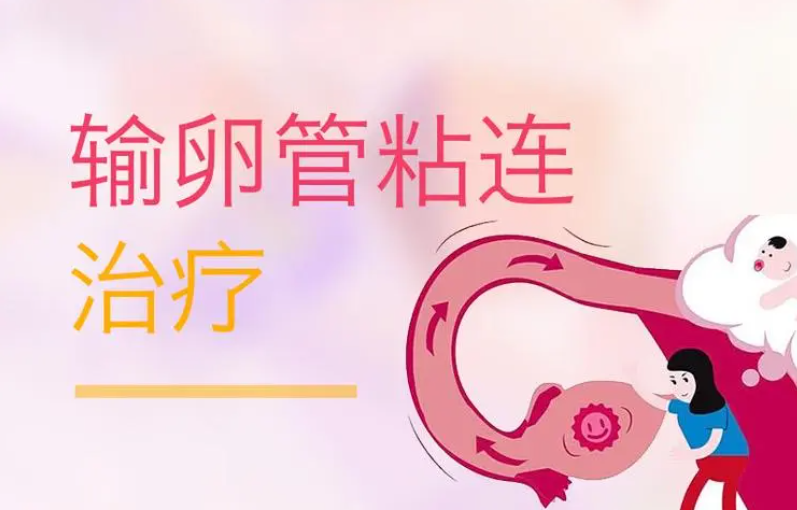 输卵管黏连治疗