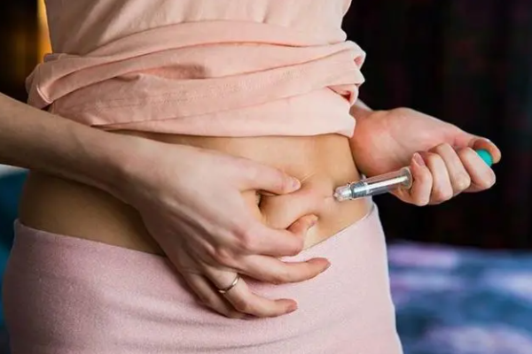 女性促排卵