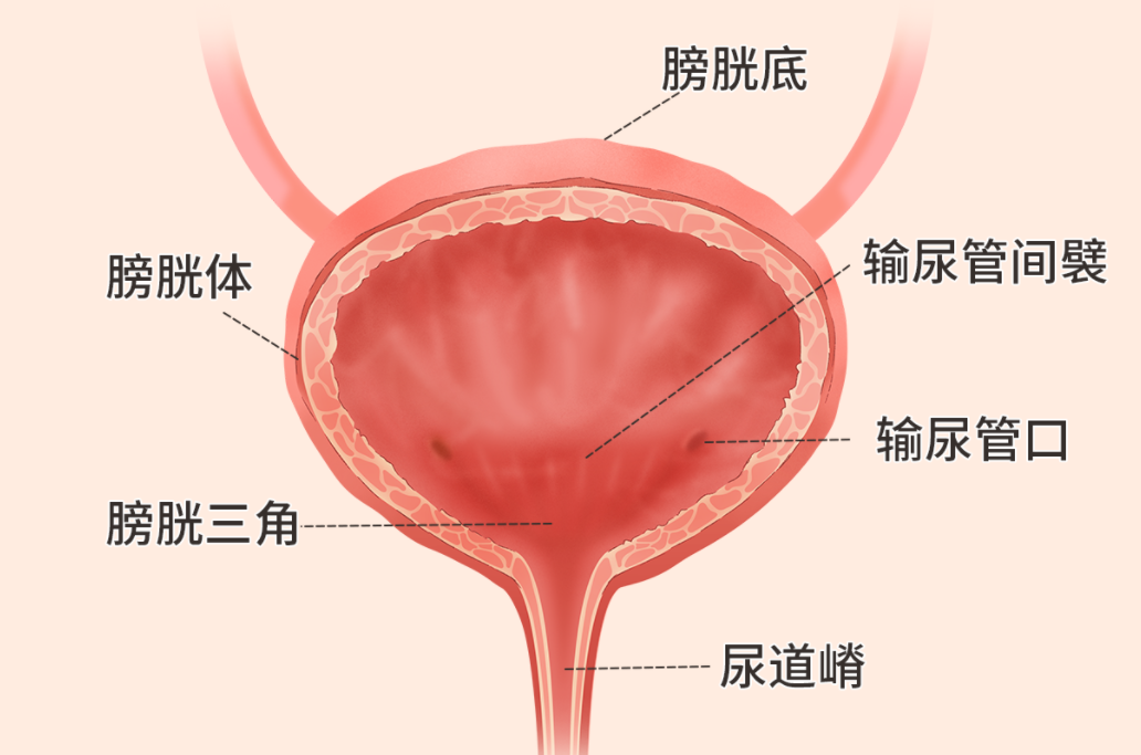 先天性膀胱颈