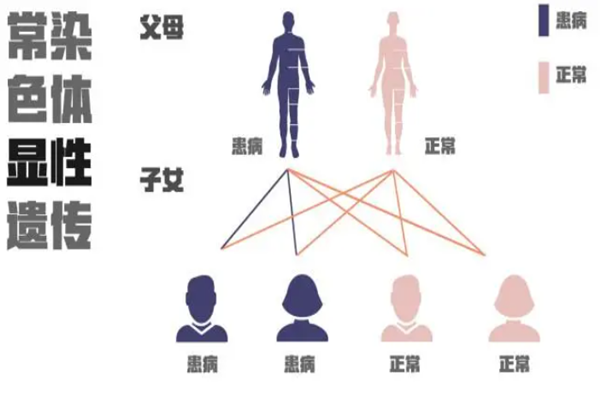 遗传因素