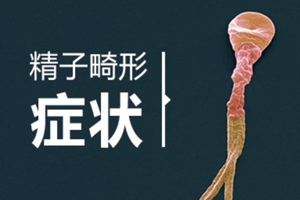 精子畸形