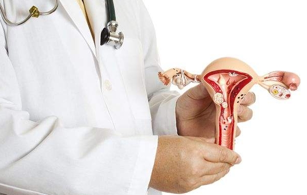 女性子宫肿瘤