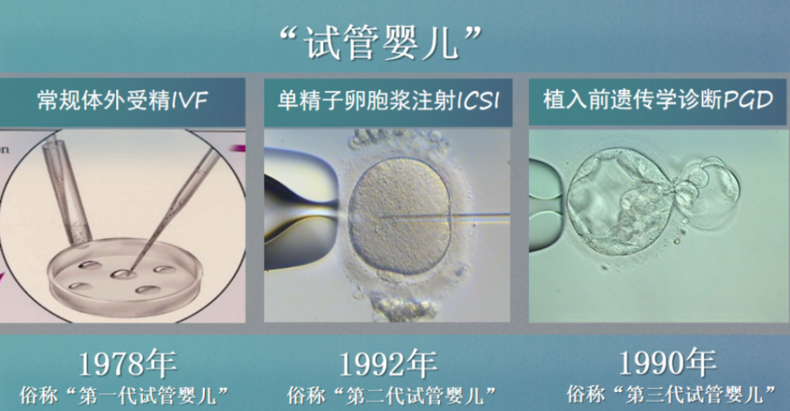 美国试管婴儿历史