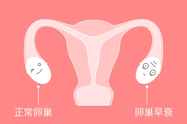 卵巢早衰