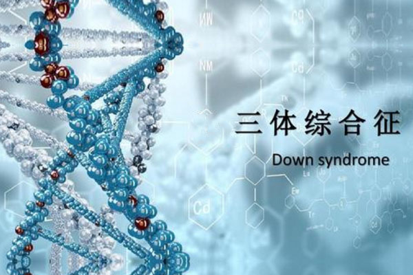 三体综合征