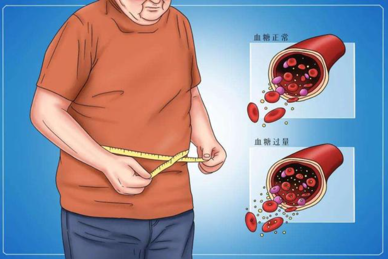 男性糖尿病