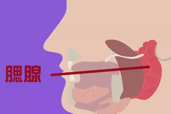 腮腺炎