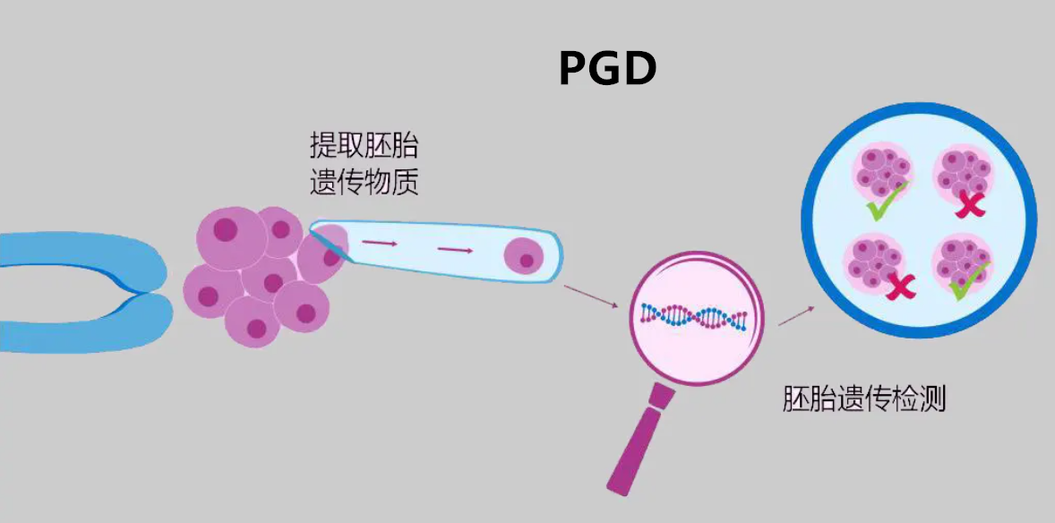 pgd基因筛查