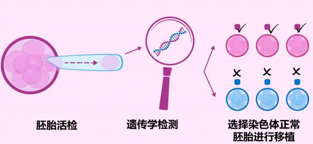 美国试管婴儿技术