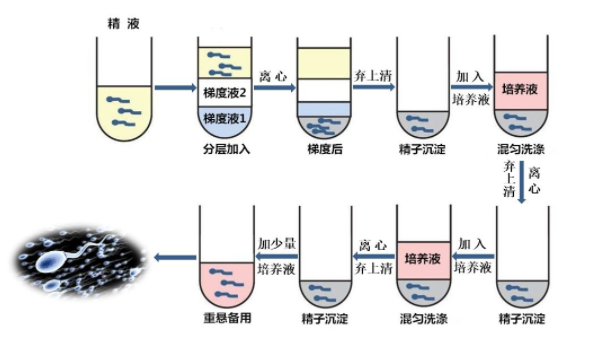 精子洗涤技术