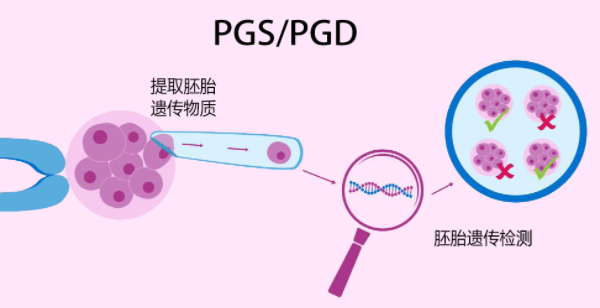囊胚基因筛查