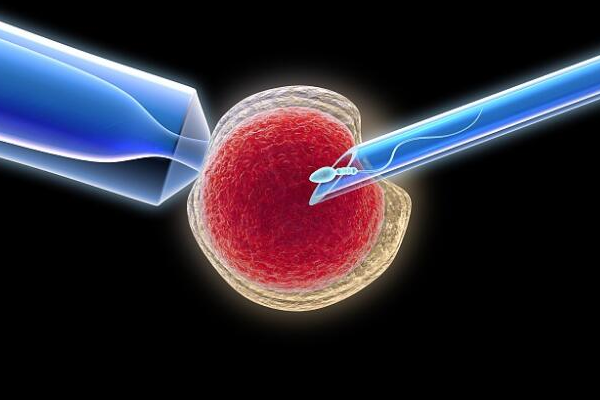 单精子注射技术