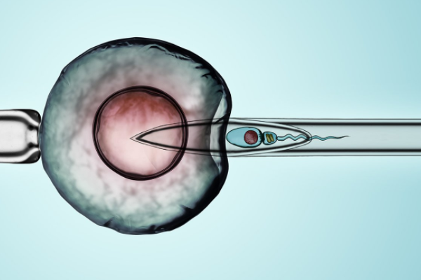 美国单精子注射技术