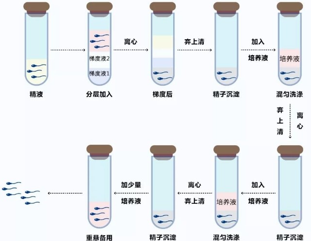 精子洗涤技术过程