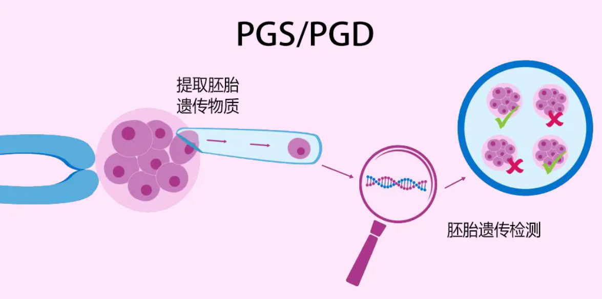 PGS技术