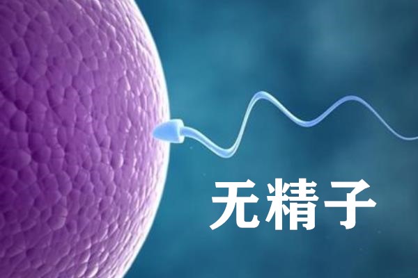 无精子