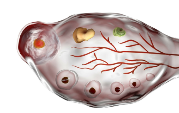 卵巢发育异常