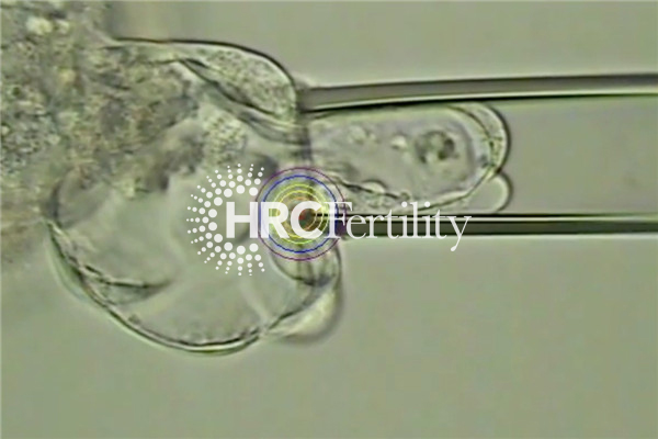 细胞提取-囊胚-HRC.jpg