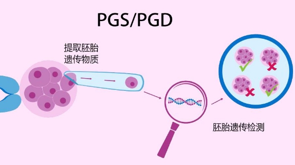 囊胚基因检查