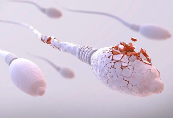 精子DNA损伤