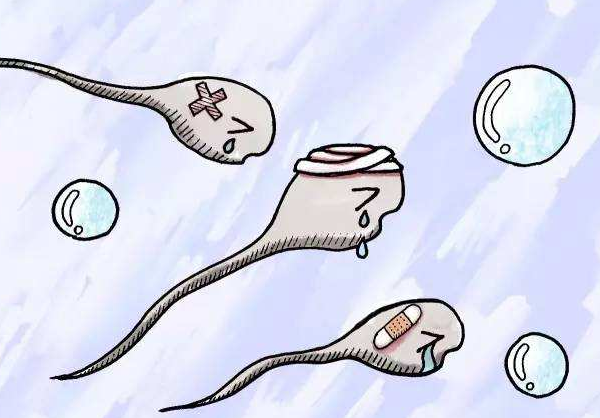 精子顶体异常