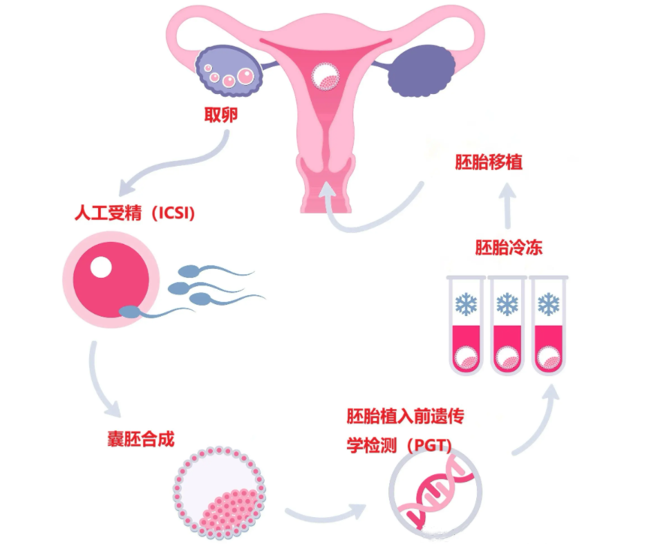 赴美试管流程