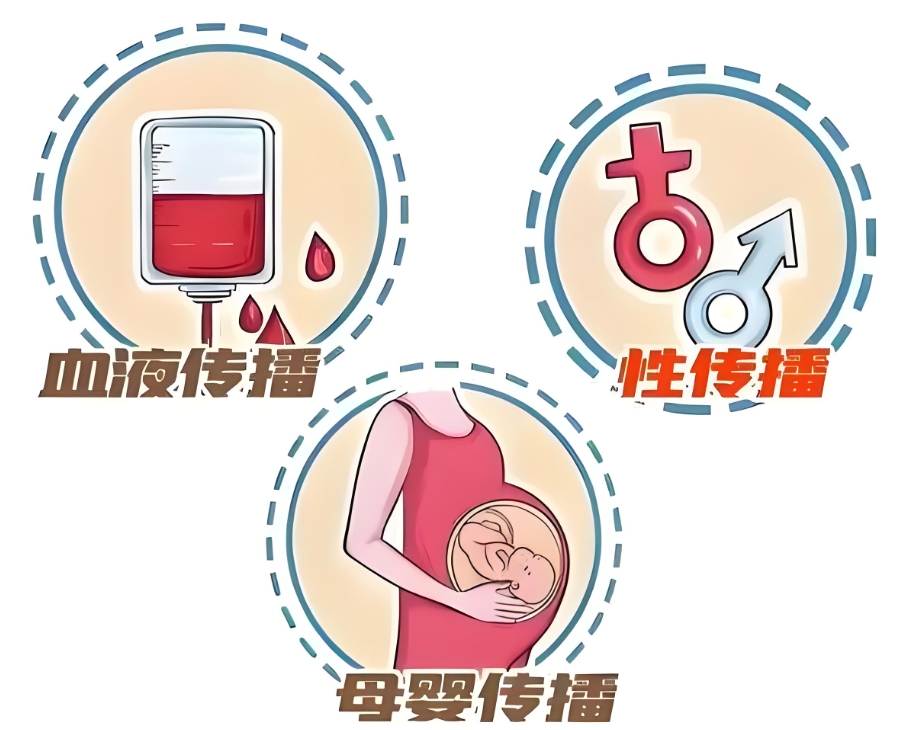 艾滋病传播途径