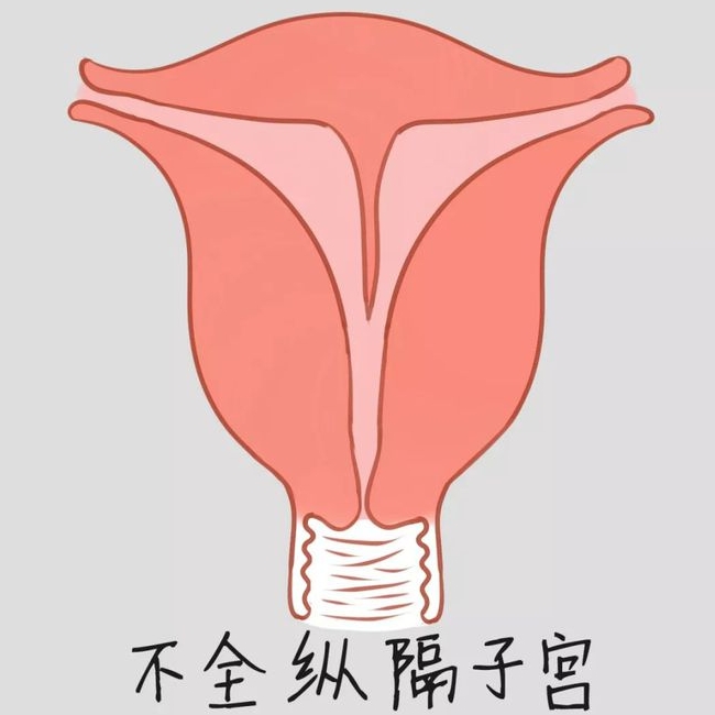 子宫发育较差