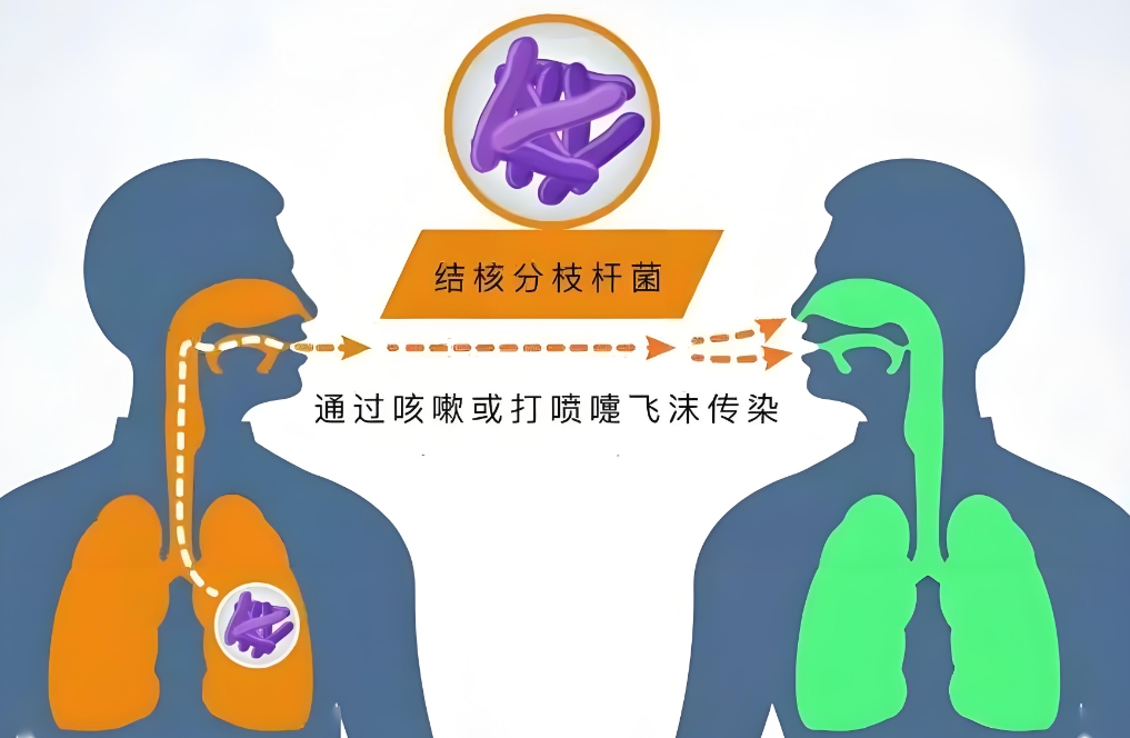 结核病