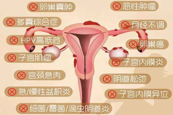 妇科病