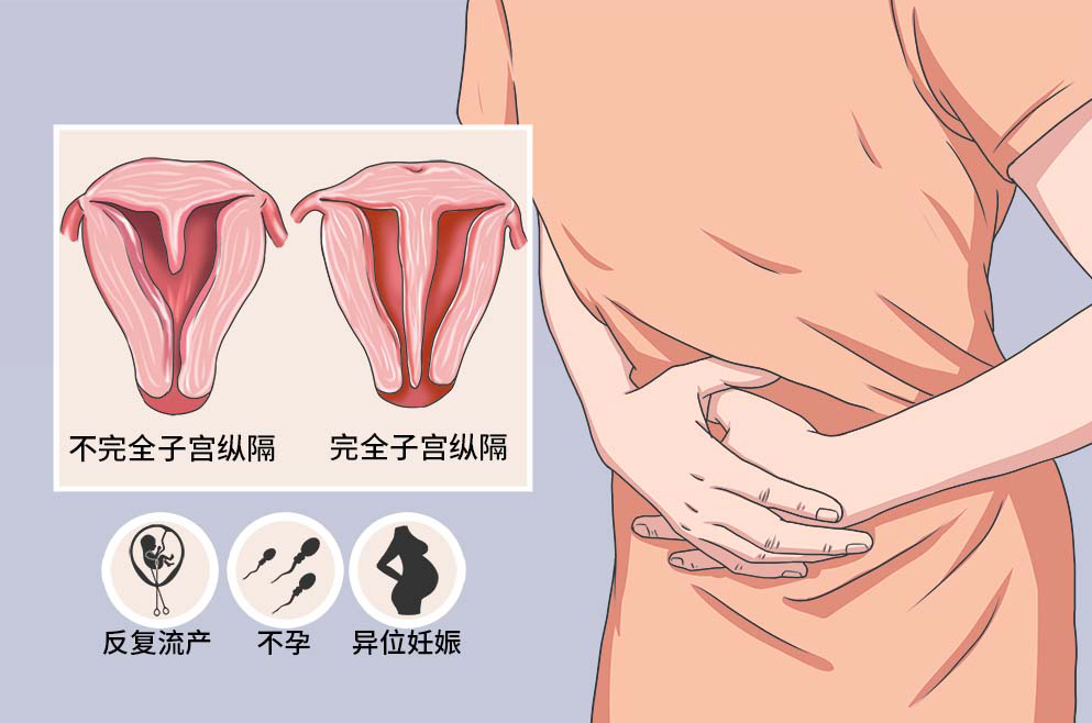 纵膈子宫