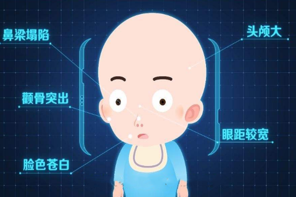 地中海贫血