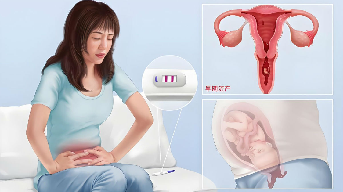 流产女性