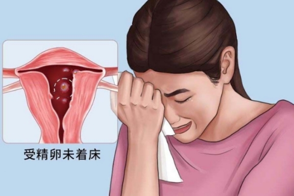 胚胎着床失败