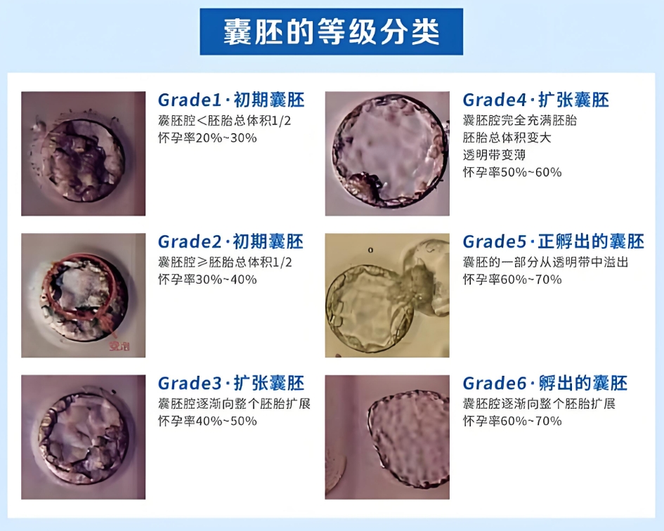 囊胚等级