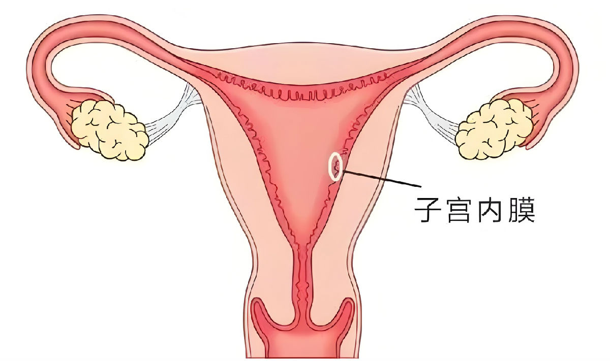 子宫内膜.jpeg