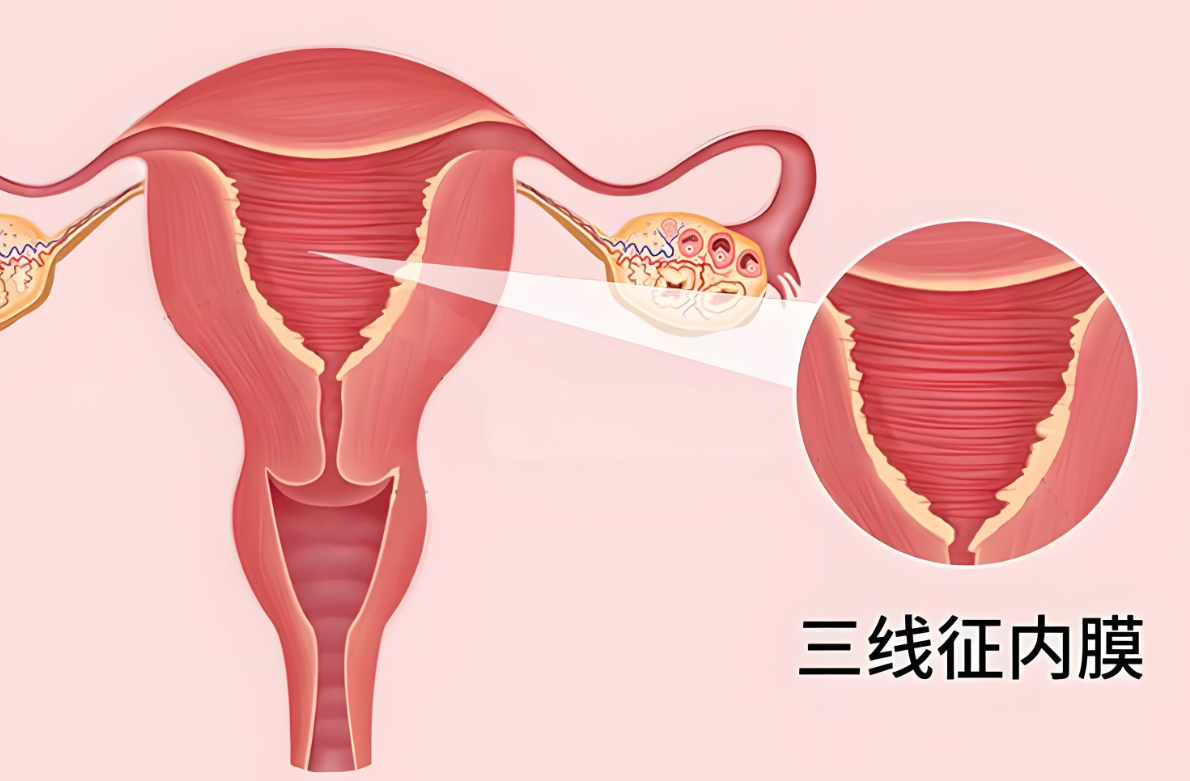 子宫内膜厚度与形态