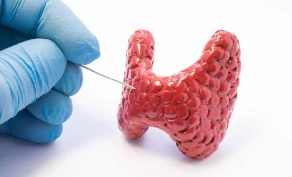 甲状腺功能异常