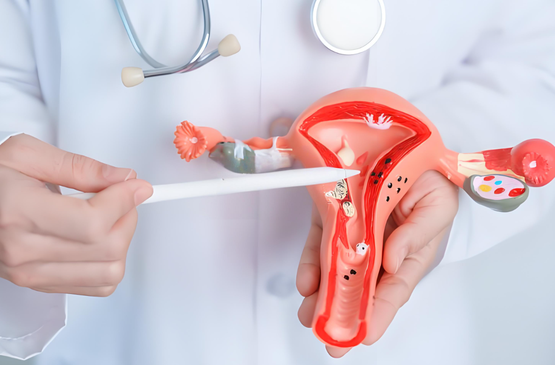 手术处理子宫问题