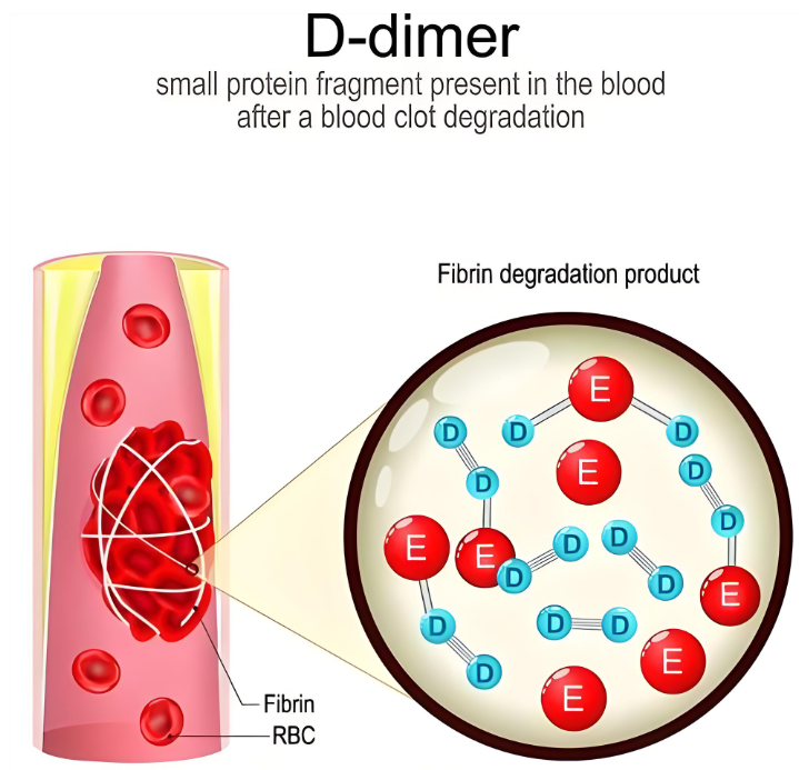 D-二聚体