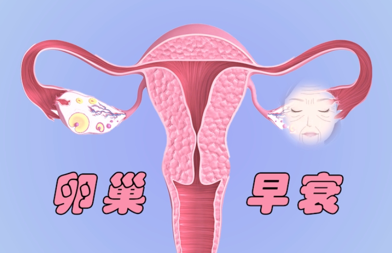 卵巢早衰