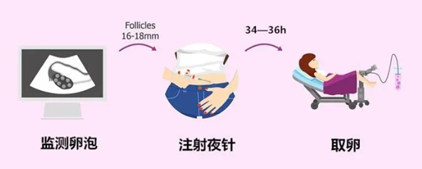 打夜针取卵