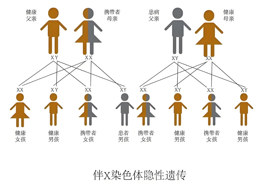 X连锁显性遗传