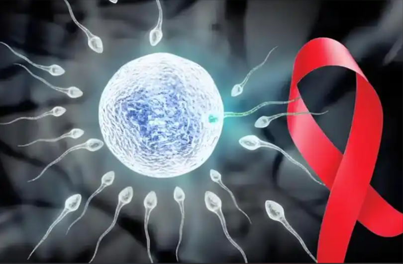 HIV精子