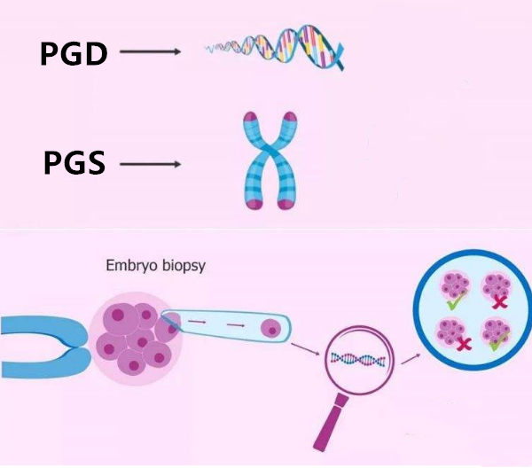 pgs/pgd