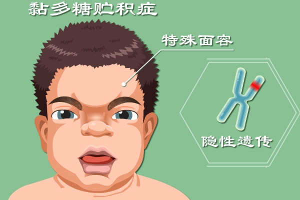 黏多糖贮积症家庭