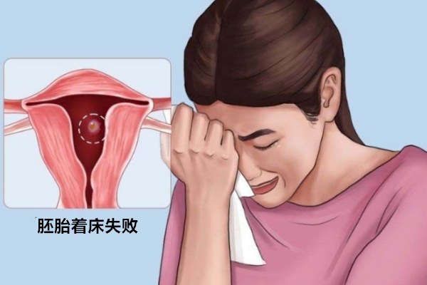 胚胎着床失败