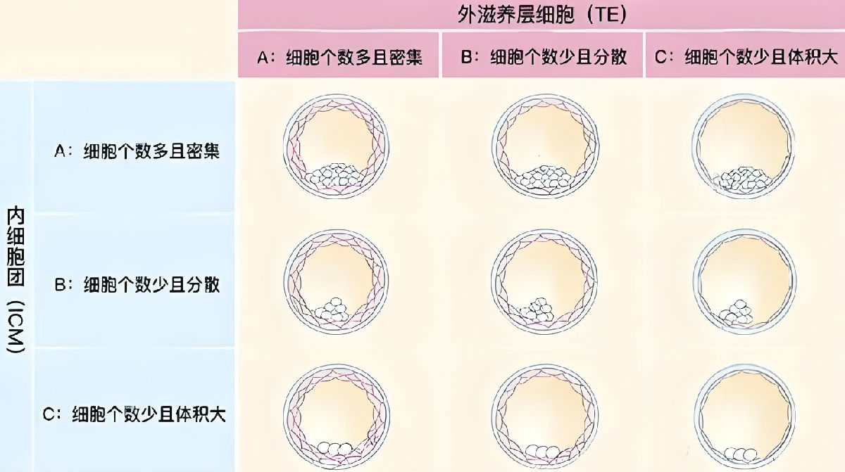 胚胎等级