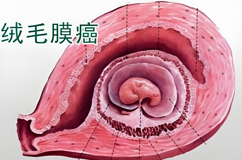 b61c29525f0e1ca737dca54afe6c3ce0.png